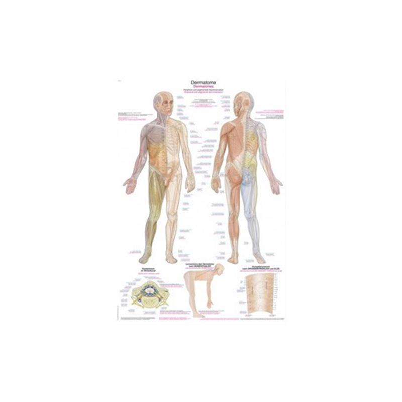 Plakat dermatomas